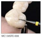MC 138SFE-008 Фреза Миллениум твердосплавная зуботехническая . НТИ Германия ( NTI )